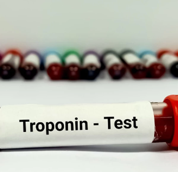 Trop T Test (Troponin T): Normal Range, Heart Attack Detection & Positive Result Treatment