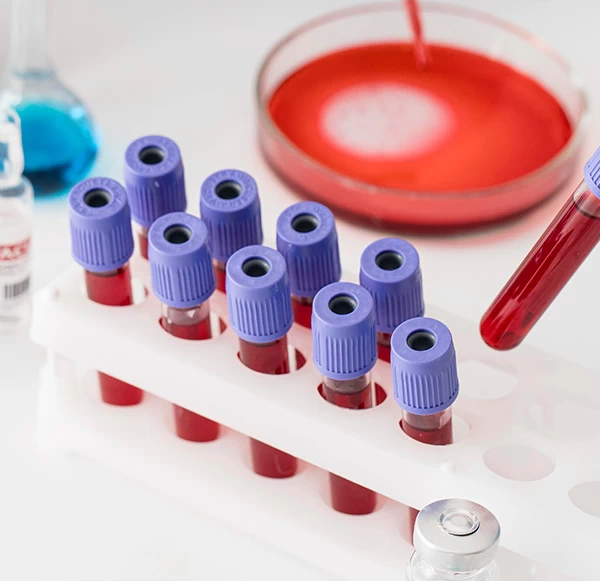 What Is the Hemogram Test Price at Mahajan Imaging & Labs, and What Affects It?