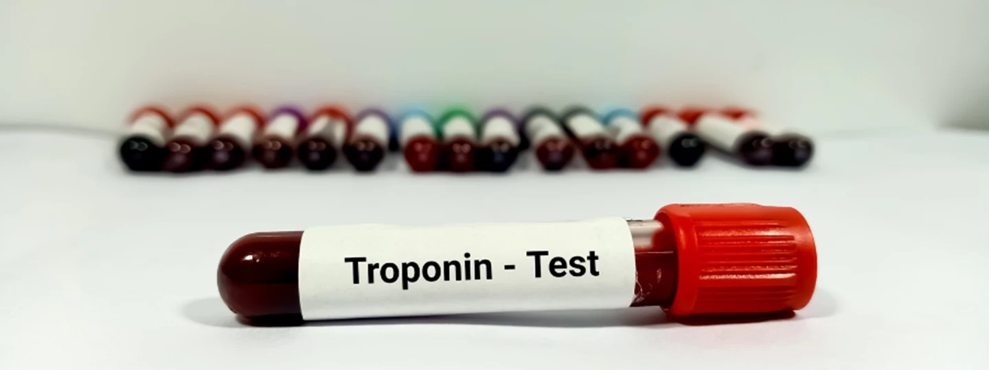 Trop T Test (Troponin T): Normal Range, Heart Attack Detection & Positive Result Treatment